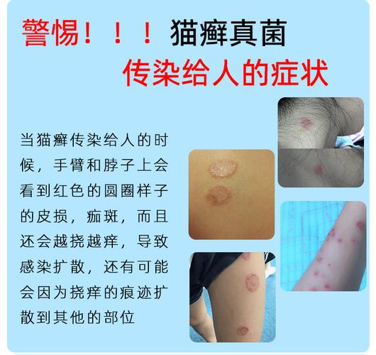视频：猫咪猫癣可以擦红霉素软膏吗？