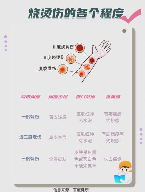 夏季儿童烧烫伤高发 三点急救口诀切记牢