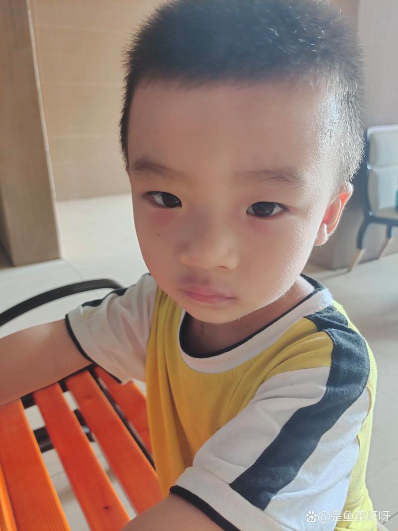 两岁男孩嘴周边有汗毛正常吗？